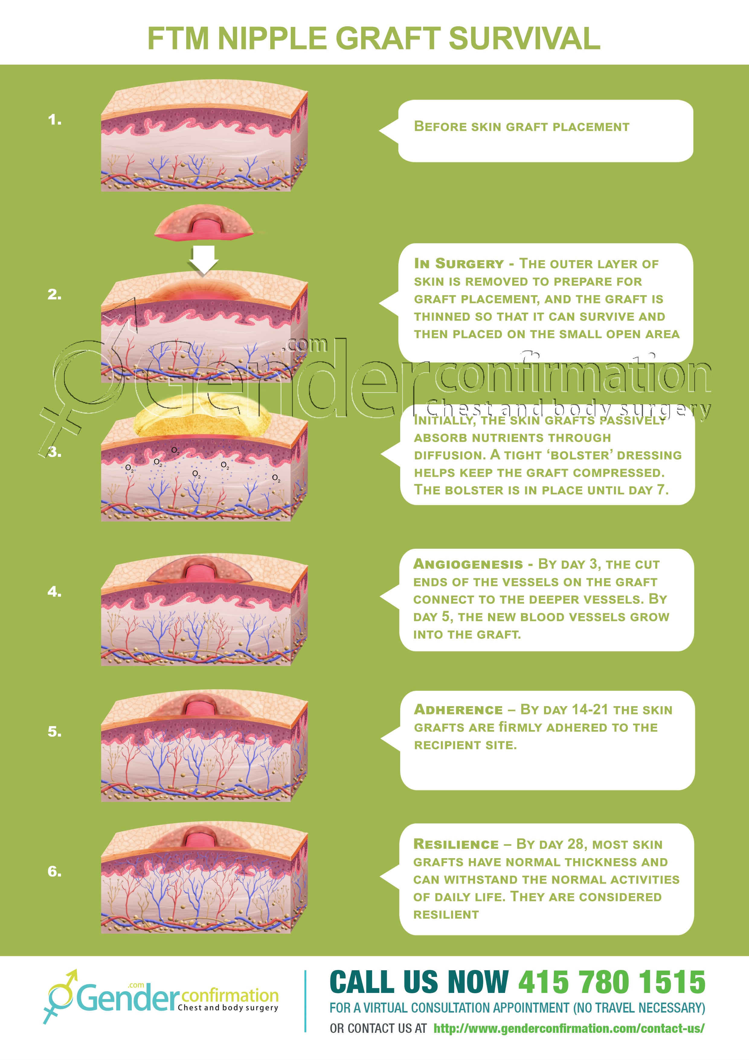 three stages of skin graft healing