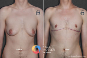 b01_1before_after-900x600