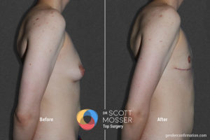 b01_3before_after_900x600