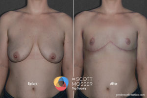 b02_1before_after_900x600