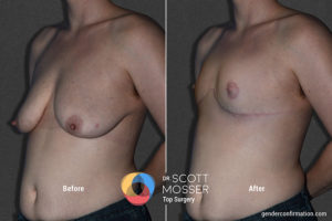 b02_2before_after_900x600