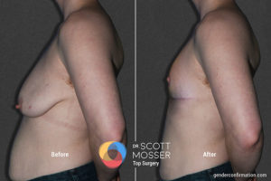 b02_3before_after_900x600