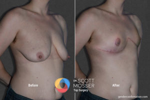 b02_4before_after800x