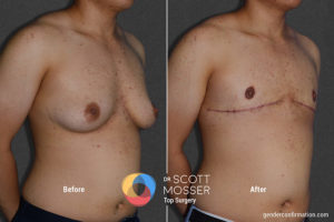 b03_2before_after_900x600