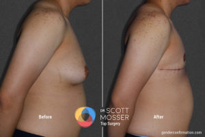 b03_3before_after_900x600