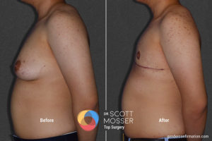 b03_5before_after_900x600