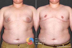 B05_01_Before_After