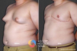 B05_02_Before_After