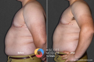 B05_03_Before_After