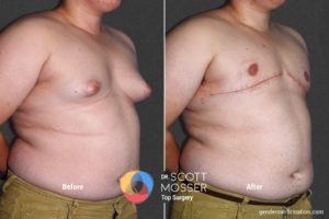 B05_04_Before_After
