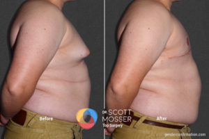 B05_05_Before_After