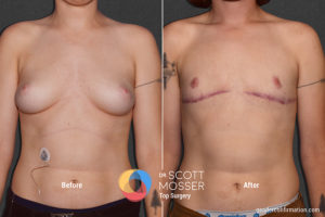 B06_03_Before_After