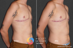 B06_04_Before_After