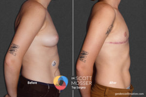 B06_05_Before_After