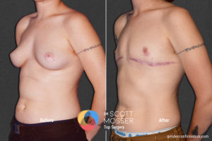 B06_06_Before_After
