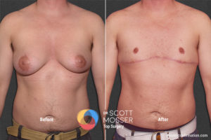 B07_01_Before_After