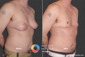 B07_02_Before_After