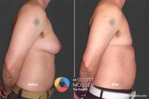 B07_03_Before_After