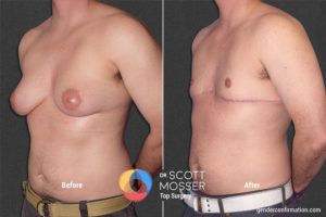 B07_04_Before_After