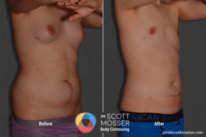 BM04_02_Before_After900X600
