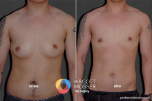 k01_1_before_after_900x600