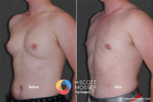 k02_2before_after_900x600