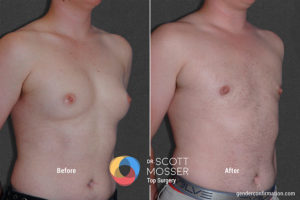 k02_4before_after_900x600