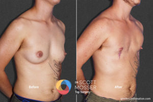 L01_2Before_After_900X600