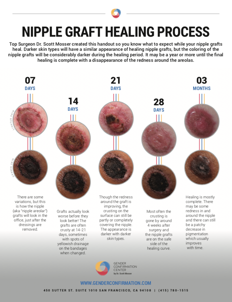 Areola Size Chart