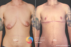 B12 1_Before_After 900X600