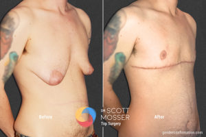 B12 2_Before_After 900X600