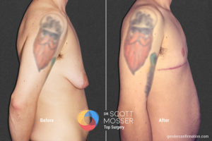 B12 3_Before_After 900X600
