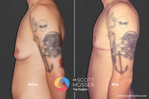 B12 5_Before_After 900X600