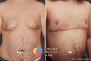 B13 1_Before_After 900X600
