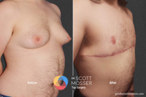 B13 2_Before_After 900X600