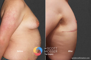 B13 3_Before_After 900X600