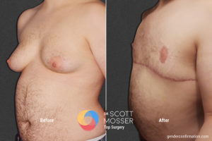 B13 4_Before_After 900X600