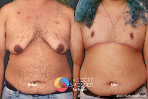 B14 1_Before_After 900X600