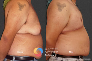 B14 3_Before_After 900X600