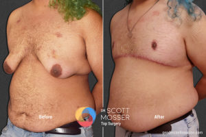 B14 4_Before_After 900X600