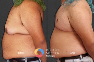 B14 5_Before_After 900X600