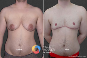 B11_1_Before_After_900X600