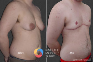 B11_2_Before_After_900X600