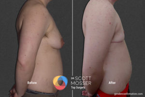 B11_3_Before_After_900X600