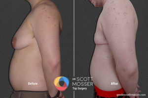 B11_5_Before_After_900X600