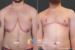 B15 1_Before_After 900X600