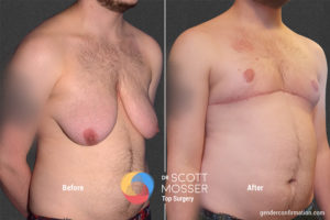 B15 2_Before_After 900X600