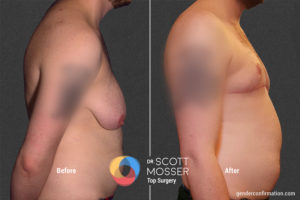 B15 3_Before_After 900X600