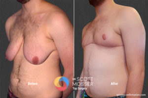 B15 4_Before_After 900X600
