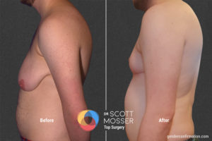 B15 5_Before_After 900X600